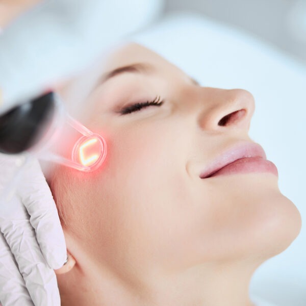 Anders als die meisten Akne-Behandlungen bekämpft die Laser-Behandlung die Ursache der Krankheit