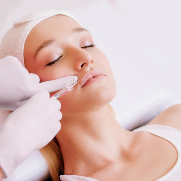 Lippenunterspritzung mit Hyaluronsäure in Kiel