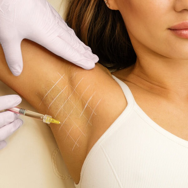 Botox kann auch medizinisch vielseitig eingesetzt werden - etwa um Schweißdrüsen lahmzulegen oder Migräne zu lindern.